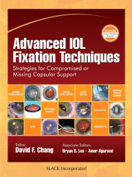 Title: Advanced IOL Fixation Techniques: Strategies for Compromised or Missing Capsular Support, Author: David Chang