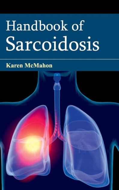 Handbook Of Sarcoidosis By Karen Mcmahon 9781632422170 Hardcover Barnes And Noble® 3683