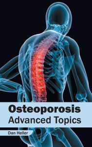 Title: Osteoporosis: Advanced Topics, Author: Dan Heller
