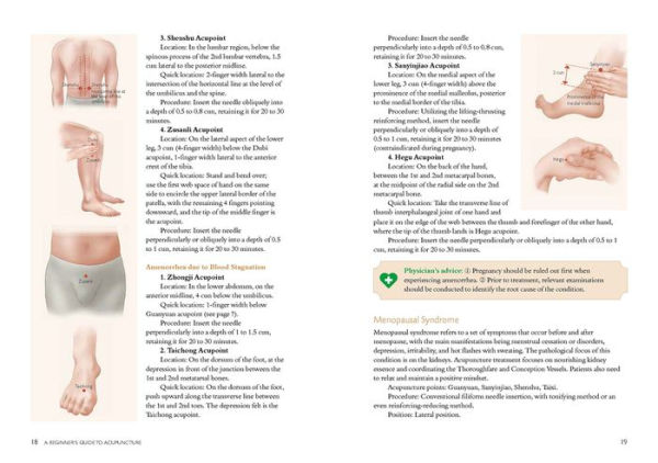 A Beginner's Guide to Acupuncture: Treating Common Ailments through Traditional Chinese Medicine