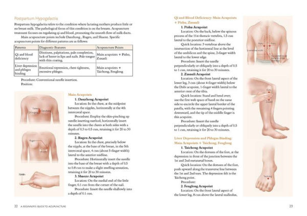 A Beginner's Guide to Acupuncture: Treating Common Ailments through Traditional Chinese Medicine