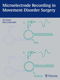 Title: Microelectrode Recording in Movement Disorder Surgery, Author: Zvi Israel