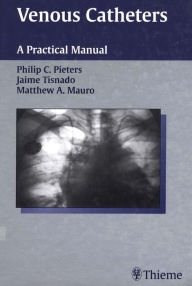 Title: Venous Catheters: A Practical Manual, Author: Philip C. Pieters