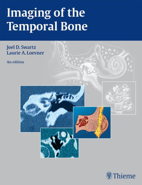 Imaging of the Temporal Bone