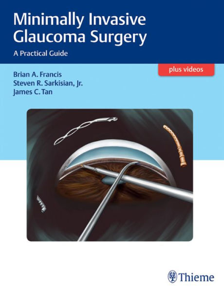 Minimally Invasive Glaucoma Surgery: A Practical Guide
