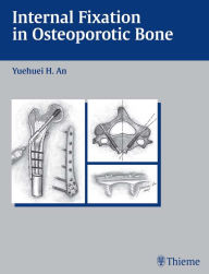 Title: Internal Fixation in Osteoporotic Bone, Author: Yuehuei H. An