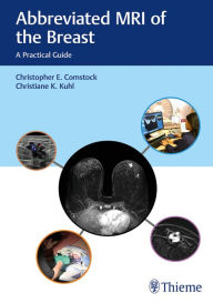 Title: Abbreviated MRI of the Breast: A Practical Guide, Author: Christopher E. Comstock