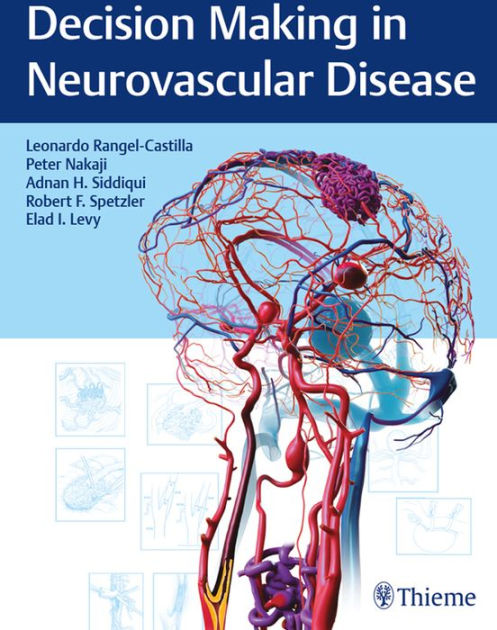 健康・医学 Decision Making in Neurovascular Disease Decision Making in Neurovascular Disease: 9781684200573: Medicine