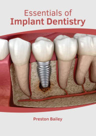 Title: Essentials of Implant Dentistry, Author: Preston Bailey