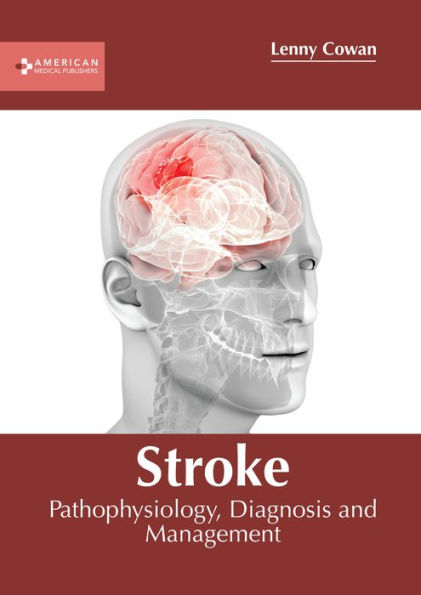 Barnes And Noble Stroke Pathophysiology Diagnosis And Management