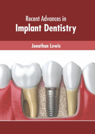 Title: Recent Advances in Implant Dentistry, Author: Jonathan Lewis