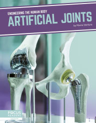 Title: Artificial Joints, Author: Marne Ventura