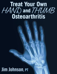 Title: Treat Your Own Hand and Thumb Osteoarthritis, Author: Jim Johnson