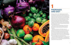 Alternative view 5 of The Psoriasis Diet Cookbook: Easy, Healthy Recipes to Soothe Your Symptoms