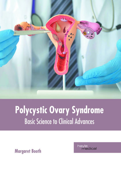 Polycystic Ovary Syndrome: Basic Science to Clinical Advances