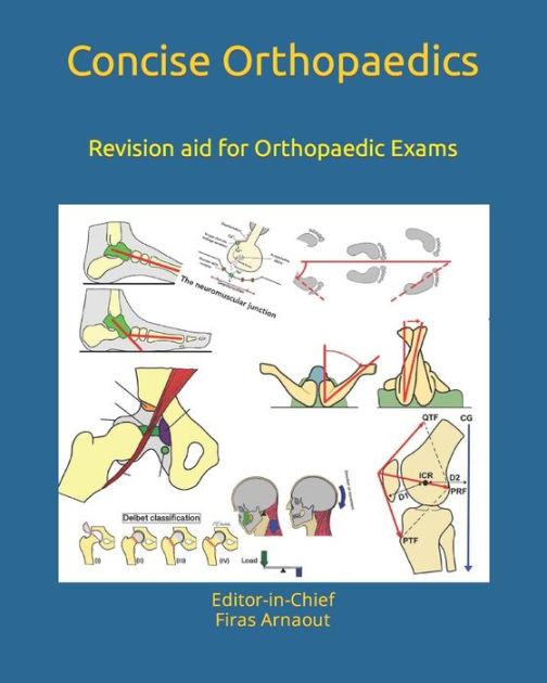 Concise Orthopaedic Notes Revision aid for FRCS , EBOT , SICOT and
