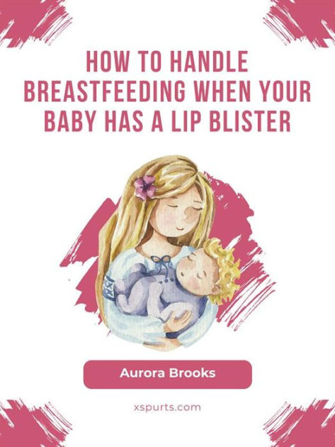 how-to-handle-breastfeeding-when-your-baby-has-a-lip-blister-by-aurora