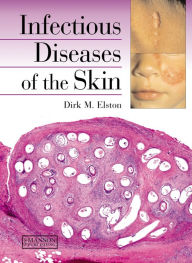 Title: Infectious Diseases of the Skin, Author: Dirk Elston