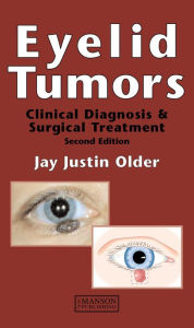 Title: Eyelid Tumors, Author: Jay Justin Older