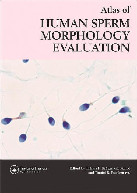 Atlas Of Human Sperm Morphology Evaluation By Thinus F Kruger Hardcover Barnes And Noble®