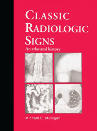 Title: Classic Radiologic Signs: An Atlas and History / Edition 1, Author: M.E. Mulligan