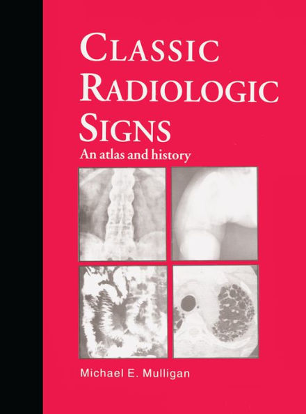 Classic Radiologic Signs: An Atlas and History / Edition 1