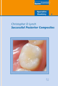 Title: Successful Posterior Composites, Author: Christopher D. Lynch