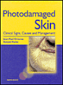 Photodamaged Skin: Clinical Signs, Causes and Management
