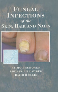 Title: Fungal Infections of the Skin and Nails, Author: Raimo E. Suhonen