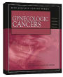 Site-Specific Cancer Series: Gynecologic Cancers / Edition 1