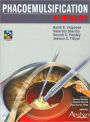 Phacoemulsification Surgery