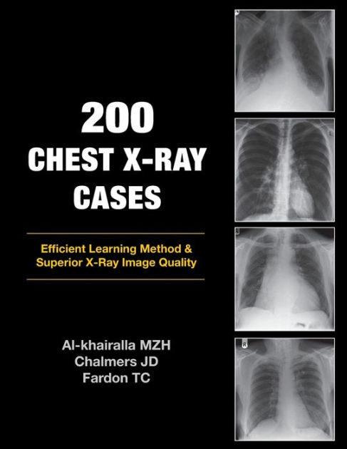 Anatomy for Radiology: Chest – Glass Box