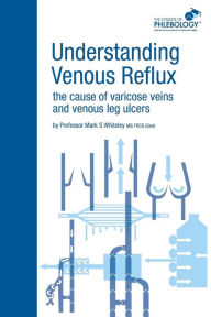 Title: Understanding Venous Reflux the Cause of Varicose Veins and Venous Leg Ulcers: Varicose veins and venous leg ulcers, Author: Mark S Whiteley