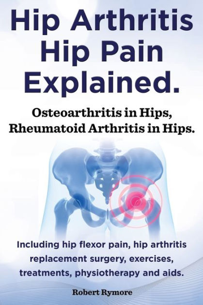 Hip Arthritis, Hip Pain Explained. Osteoarthritis in Hips, Rheumatoid