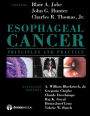 Esophageal Cancer: Principles and Practice / Edition 1