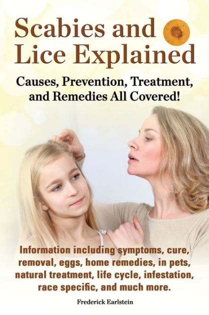 Scabies and Lice Explained. Causes, Prevention, Treatment, and Remedies All  Covered! Information Including Symptoms, Removal, Eggs, Home Remedies, in  by Frederick Earlstein, Paperback