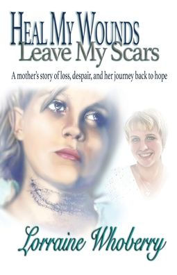 Heal My Wounds, Leave My Scars: A Mother's Story Of Loss, Despair, And 