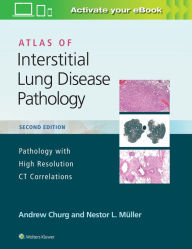 Title: Atlas of Interstitial Lung Disease Pathology / Edition 2, Author: Andrew Churg MD
