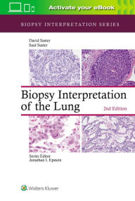 Title: Biopsy Interpretation of the Lung / Edition 2, Author: Saul Suster MD