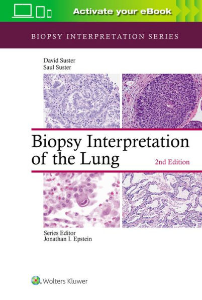 Biopsy Interpretation of the Lung / Edition 2