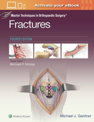 Title: Master Techniques in Orthopaedic Surgery: Fractures / Edition 4, Author: Michael J. Gardner MD