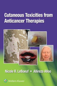 Title: Cutaneous Reactions from Anti-Cancer Therapies, Author: Allireza Alloo