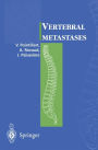 Vertebral metastases / Edition 1
