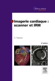 Title: Imagerie cardiaque : scanner et IRM, Author: Olivier Vignaux