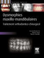 Dysmorphies maxillo-mandibulaires: Traitement orthodontico-chirurgical