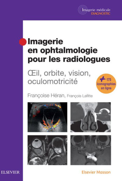 Imagerie en ophtalmologie pour les radiologues: Oeil, orbite, vision, oculomotricité