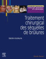 Traitement chirurgical des séquelles de brûlures