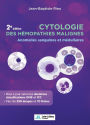 Cytologie des hémopathies malignes (2e édition): Anomalies sanguines et médullaires