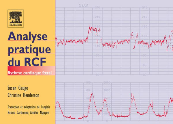 Analyse pratique du RCF: Rythme cardiaque fotal