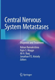 Title: Central Nervous System Metastases: Diagnosis and Treatment, Author: Rohan Ramakrishna